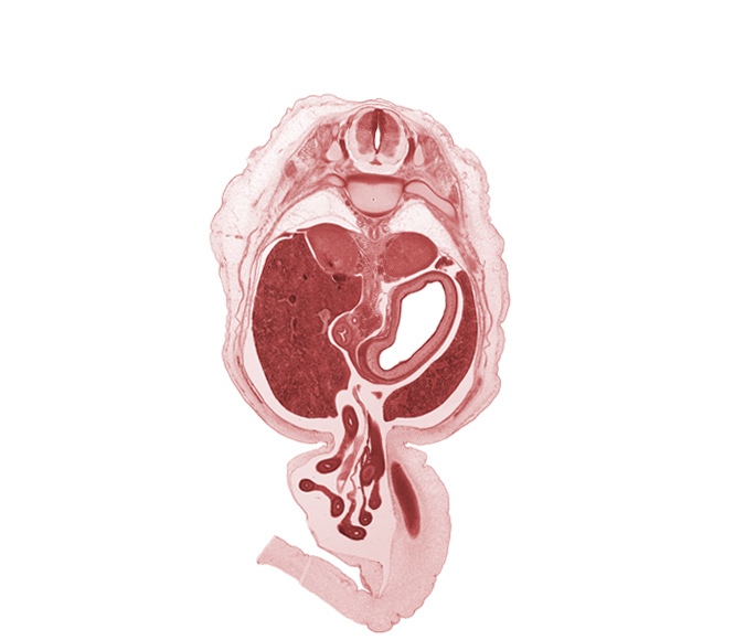 T-10 / T-11 intervertebral disc, T-11 spinal ganglion, aorta, bile duct, centrum of T-11 vertebra, descending part of duodenum (second part), distal limb of herniated midgut, head of rib 11, jejunum, left lobe of liver, lumen of body of stomach, mesentery, notochord, proximal limb of herniated midgut, superior mesenteric artery, testis, umbilical vein