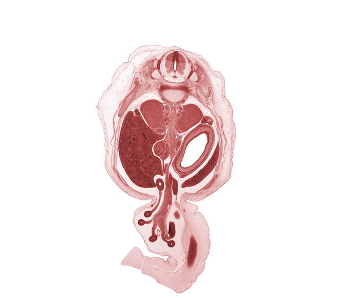 T-11 / T-12 intervertebral disc, T-11 spinal nerve, T-12 spinal ganglion, allantois, aorta, celiac ganglion, centrum of T-12 vertebra, descending part of duodenum (second part), distal limb of herniated midgut, greater curvature of stomach, head of ventral pancreas, hindgut (colon), jejunum, proximal limb of herniated midgut, rectus abdominis muscle, spleen, testis, umbilical vein