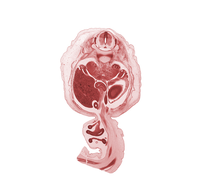 T-12 / L-1 intervertebral disc, T-12 spinal ganglion, T-12 spinal nerve, allantois, body of dorsal pancreas, centrum of L-1 vertebra, distal limb of herniated midgut, duodenum, external abdominal oblique muscle, hindgut (colon), internal abdominal oblique muscle, jejunum, left umbilical artery, mesentery, muscularis of stomach, omphalomesenteric artery, proximal limb of herniated midgut, rectus abdominis muscle, right umbilical artery, subcostal nerve (T-12 ventral primary ramus), superior pole of left kidney (metanephros), transversus abdominis muscle, umbilical vein, vas deferens (mesonephric duct)