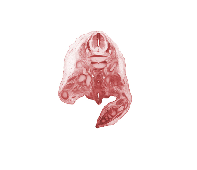 L-4 / L-5 intervertebral disc, L-4 spinal ganglion, L-5 / S-1 intervertebral disc, L-5 spinal ganglion, L-5 spinal nerve, S-1 spinal nerve, ala of sacrum, caudal edge of peritoneal cavity, centrum of S-1 vertebra (cephalic edge of sacrum), fibula, ilium, internal iliac vein, ischiorectal fossa, ischium, rectum, sciatic nerve, scrotal swelling, tarsal cartilage(s), urethra, urethral fold