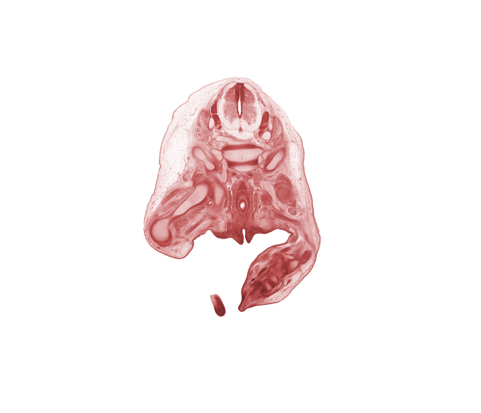 L-5 / S-1 intervertebral disc, L-5 spinal ganglion, L-5 spinal nerve, L-5 ventral root, S-1 / S-2 interganglion region, S-1 spinal ganglion, S-1 spinal nerve, blastemata of gluteal muscles, fibula, hip joint, ilium, rectum, scrotal swelling, urethral fold, urethral groove