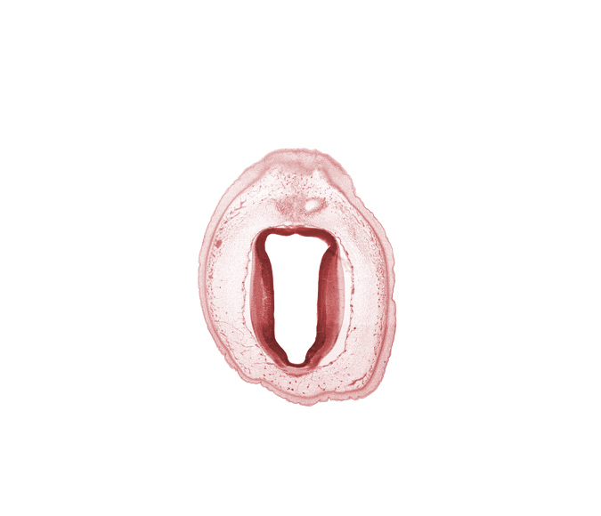 artifact separation(s), cerebral aqueduct (mesocoele), commissure of superior colliculus, edge of metencephalon, intermediate zone, loose connective tissue, marginal zone, osteogenic layer, subarachnoid space, surface ectoderm, ventricular zone