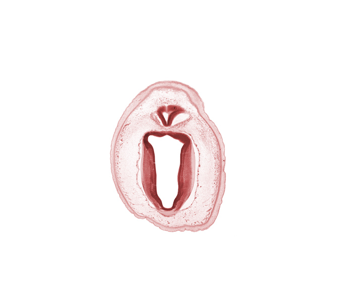 artifact separation(s), cerebral aqueduct (mesocoele), commissure of superior colliculus, edge of rhombencoel (fourth ventricle), metencephalon, subarachnoid space