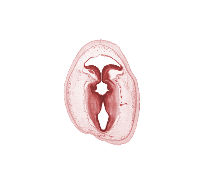 artifact separation(s), cerebral aqueduct (mesocoele), commissure of superior colliculus, junction of cerebral aqueduct and rhombencoel (fourth ventricle), loose connective tissue, osteogenic layer, rhombencoel (fourth ventricle), root of trochlear nerve (CN IV), subarachnoid space, surface ectoderm, vascular plexus