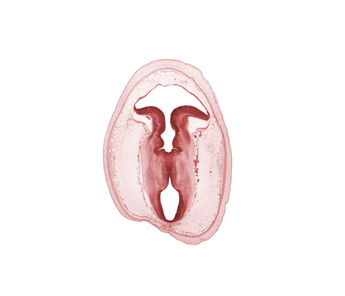 artifact separation(s), cerebral aqueduct (mesocoele), intermediate zone, marginal zone, rhombencoel (fourth ventricle), subarachnoid space, vascular plexus, ventricular zone