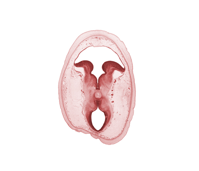 artifact separation(s), dural limiting membrane, edge of interpeduncular fossa, intermediate zone, loose connective tissue, marginal zone, osteogenic layer, subarachnoid space, sulcus limitans, surface ectoderm, tectum, tegmentum, trochlear nerve (CN IV), vascular plexus, ventricular zone