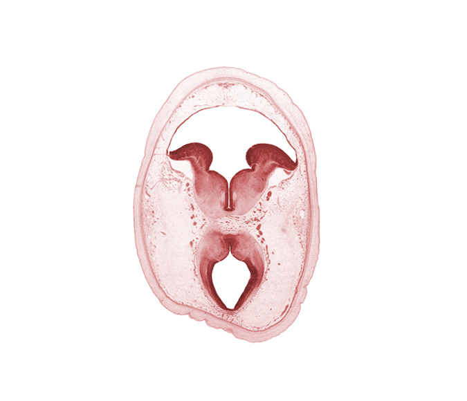 artifact separation(s), basis pedunculi of pons region (metencephalon), cerebral aqueduct (mesocoele), habenulo-interpeduncular tract, osteogenic layer, posterior cerebellar artery, root of oculomotor nerve (CN III), subarachnoid space, sulcus limitans, superior cerebellar artery, surface ectoderm, tectum, tegmentum, trochlear nerve (CN IV), vascular plexus