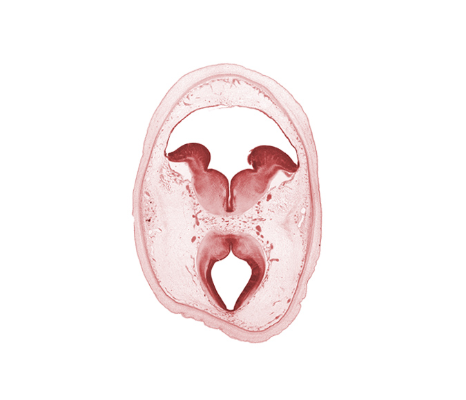 alar plate of metencephalon (cerebellum), artifact separation(s), basal plate, cerebral aqueduct (mesocoele), floor plate, interpeduncular nucleus, median sulcus, mesencephalon, oculomotor nucleus, region of mesencephalic (cephalic) flexure, rhombencoel (fourth ventricle), roof plate, sulcus limitans, superior cerebellar artery, trochlear nerve (CN IV)