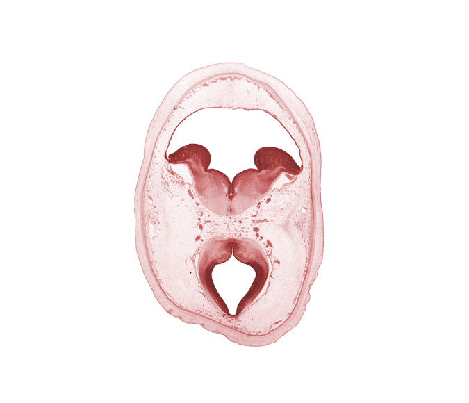 artifact separation(s), cerebral aqueduct (mesocoele), mesencephalon, oculomotor nucleus, osteogenic layer, posterior cerebral artery, roof of rhombencoel (fourth ventricle), root of oculomotor nerve (CN III), subarachnoid space, subcutaneous tissue, surface ectoderm, trochlear nerve (CN IV)