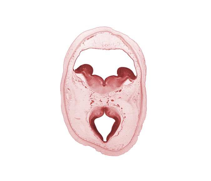 artifact separation(s), diencephalon, dorsal thalamus, junction of cerebral aqueduct and third ventricle, junction of hypothalamic sulcus and sulcus limitans, median sulcus, mesencephalon, oculomotor nerve (CN III), rhombencoel (fourth ventricle), subarachnoid space, sulcus limitans, trochlear nerve (CN IV)