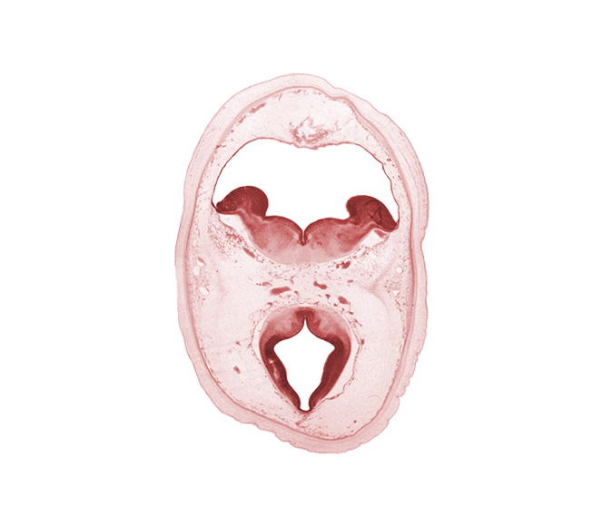 artifact separation(s), basis pedunculi of pons region (metencephalon), diencephalon, dorsal thalamus, edge of ependymal diverticulum of rhombencoel (fourth ventricle), hypothalamic sulcus, metencephalon, oculomotor nerve (CN III), osteogenic layer, posterior cerebral artery, roof of rhombencoel (fourth ventricle), sulcus dorsalis, trochlear nerve (CN IV)