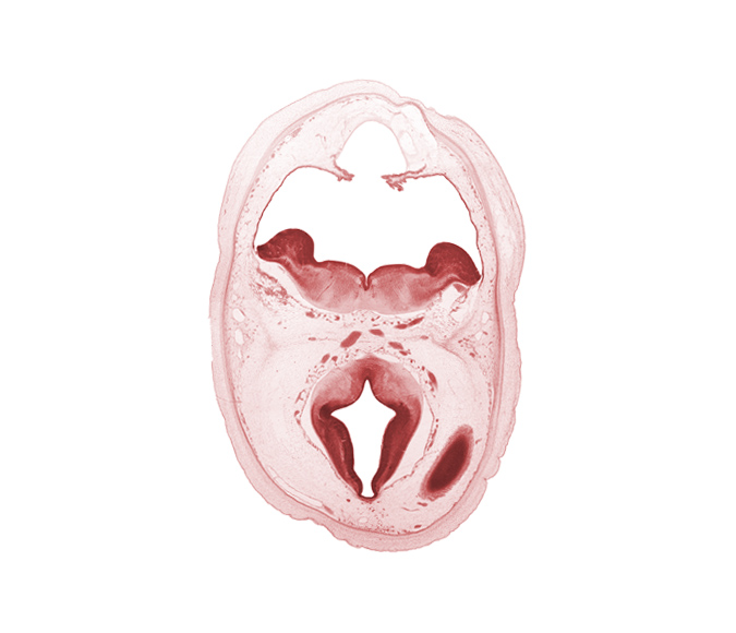 alar plate of metencephalon (cerebellum), artifact separation(s), basal plate, cephalic end of basilar artery, choroid fissure, diverticulum of rhombencoel (fourth ventricle), dorsal thalamus, hypothalamic sulcus, marginal zone of cerebral vesicle, median sulcus, oculomotor nerve (CN III), posterior communicating artery, rhombencoel (fourth ventricle), rhombic lip, roof plate, sulcus limitans, trochlear nerve (CN IV)