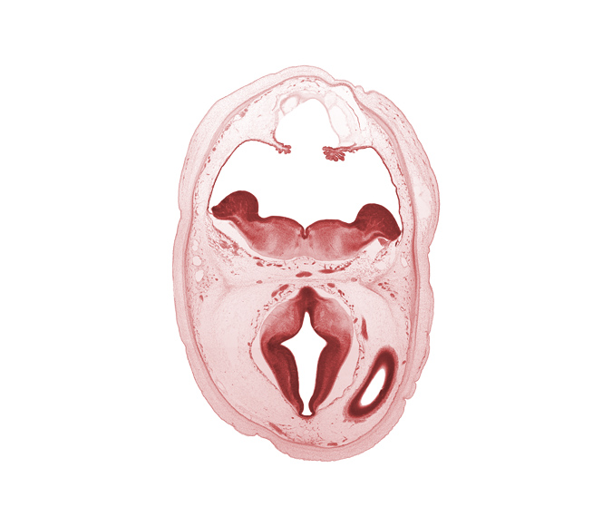 alar plate(s), basal plate, basilar artery, basis pedunculi of pons region (metencephalon), choroid plexus, diverticulum of rhombencoel (fourth ventricle), dorsal thalamus, external cerebellum, hypothalamic sulcus, intermediate zone of cerebral vesicle, internal cerebellum, lateral ventricle, median sulcus, osteogenic layer, posterior communicating artery, roof of rhombencoel (fourth ventricle), sulcus dorsalis, sulcus limitans, tegmentum of pons, third ventricle