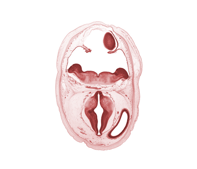 alar plate of metencephalon (cerebellum), alar plate of myelencephalon, basal plate, cerebral vesicle (telencephalon), diverticulum of rhombencoel (fourth ventricle), dorsal thalamus, hypothalamic sulcus, hypothalamus, lateral ventricle, median sulcus, oculomotor nerve (CN III), roof of rhombencoel (fourth ventricle), sulcus dorsalis, sulcus limitans, third ventricle, trochlear nerve (CN IV)