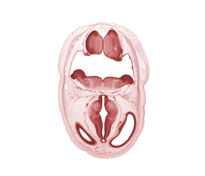 artifact separation(s), basilar artery, dural band for tentorium cerebelli, lateral ventricle, medial accessory olivary nucleus, oculomotor nerve (CN III), osteogenic layer, pons region (metencephalon), posterior communicating artery, rhombencoel (fourth ventricle), third ventricle, venous plexus(es)