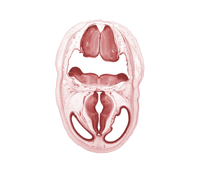 artifact separation(s), basilar artery, cerebral vesicle (telencephalon), dorsal thalamus, hypothalamic sulcus, hypothalamus, osteogenic layer, pons region (metencephalon), posterior communicating artery, rhombencoel (fourth ventricle), roof plate, subarachnoid space, ventral thalamus, zona limitans intrathalamica