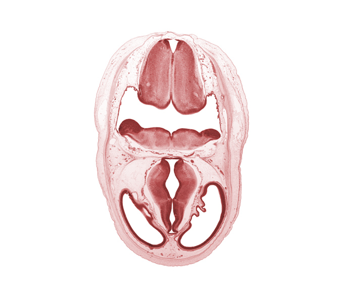 artifact separation(s), basilar artery, cerebral vesicle (telencephalon), dorsal thalamus, dural band for tentorium cerebelli, endolymphatic duct, hypothalamic sulcus, hypothalamus, intermediate zone, lateral ventricle, marginal zone, osteogenic layer, posterior communicating artery, subarachnoid space, third ventricle, ventral thalamus, ventricular zone, zona limitans intrathalamica