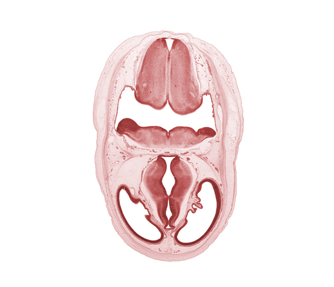 artifact separation(s), choroid plexus, dorsal thalamus, dural venous sinus, endolymphatic duct, loose connective tissue, marginal ridge, median sulcus, obex, oculomotor nerve (CN III), osteogenic layer, pons region (metencephalon), posterior communicating artery, sensory decussation, surface ectoderm, third ventricle, ventral thalamus