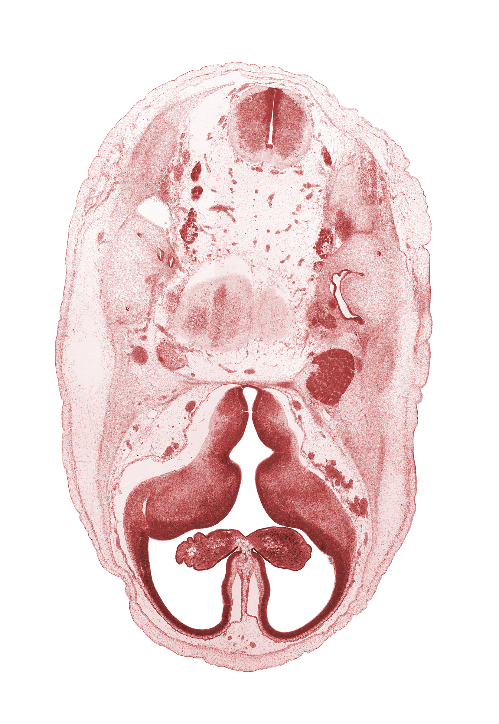 accessory nerve (CN XI), anterior semicircular duct, artifact separation(s), basilar artery, choroid fissure, choroid plexus, facial nerve (CN VII), glossopharyngeal nerve (CN IX), hypothalamic sulcus, internal carotid artery, lateral ventricular eminence (telencephalon), medial ventricular eminence (diencephalon), myelencephalon (medulla oblongata), pons region (metencephalon), posterior semicircular duct, root of abducens nerve (CN VI), root of hypoglossal nerve (CN XII), trigeminal ganglion (CN V), vagus nerve (CN X), vestibulocochlear ganglion (CN VIII)