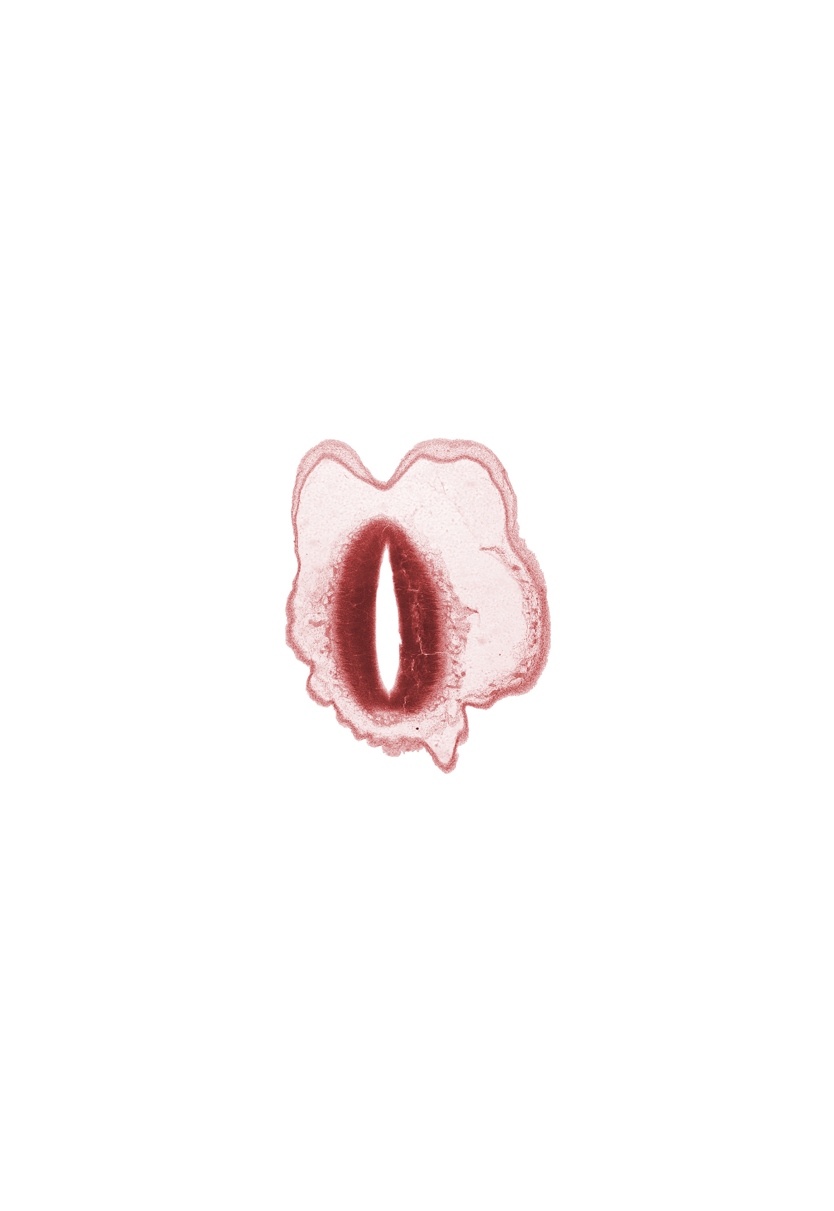 cerebral aqueduct (mesencoel), mesencephalon, osteogenic layer, tectum of mesencephalon