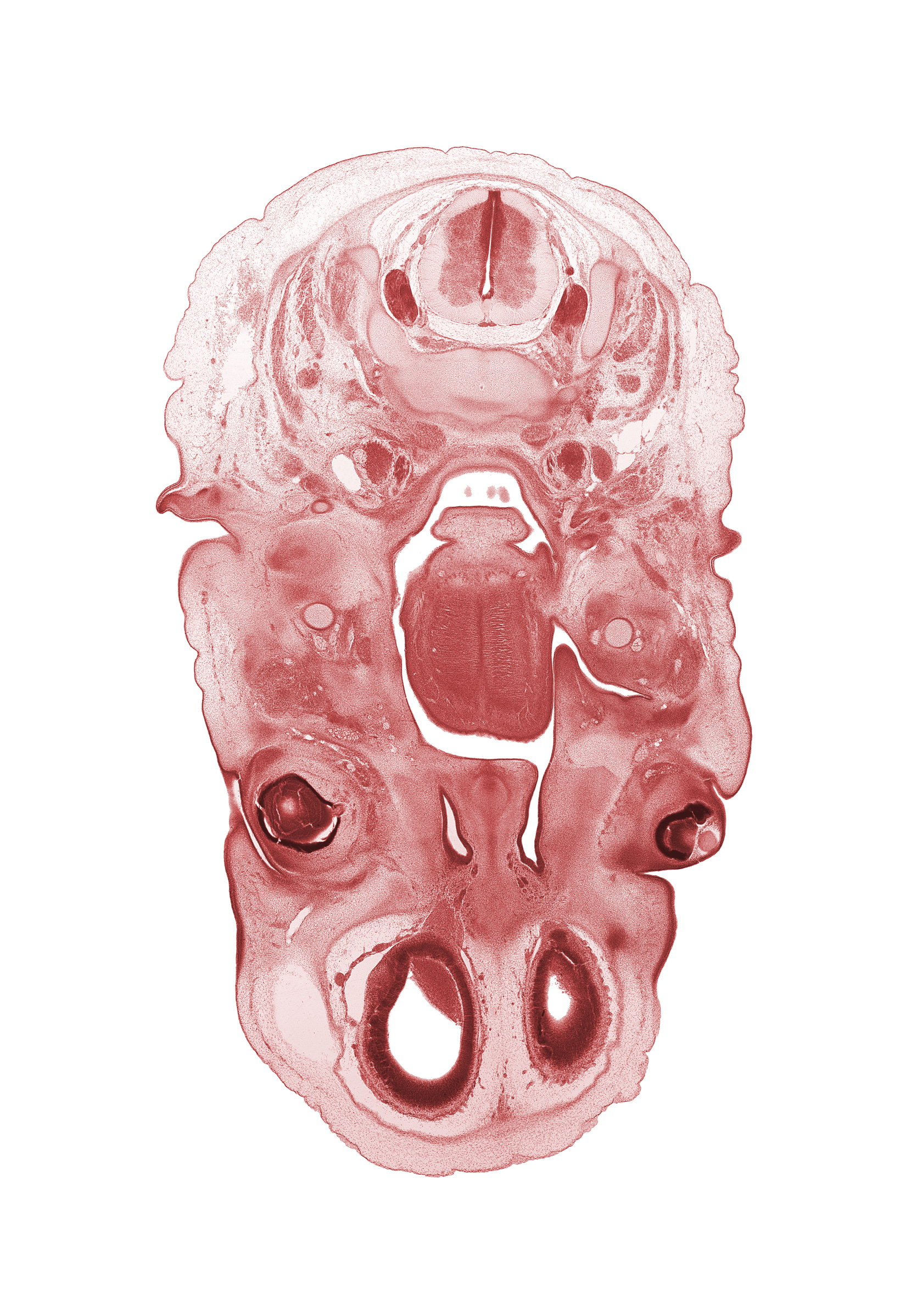 C-3 spinal ganglion, C-3 spinal nerve, auricle, dorsal root(s), edge of lateral ventricle, edge of lens, edge of optic cup cavity, epiglottis, frontal prominence, glossopharyngeal nerve (CN IX), hypoglossal nerve (CN XII), inferior ganglion of vagus nerve (CN X), nasal cavity (nasal sac), olfactory bulb, olfactory filia (CN I), palatine shelf, pharyngeal arch 1 cartilage (Meckel), retropharyngeal space, superior cervical sympathetic ganglion