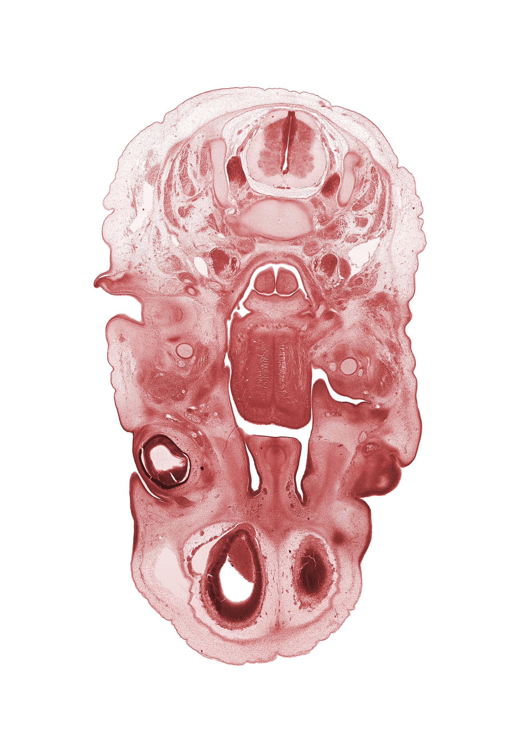 C-3 spinal ganglion, C-3 spinal nerve, auricle, blastema of extra-ocular muscle(s), choana, edge of cerebral vesicle(s), epiglottis, external acoustic meatus, glossopharyngeal nerve (CN IX), inferior ganglion of vagus nerve (CN X), internal jugular vein, lateral ventricle, lingual nerve, middle pharyngeal constrictor muscle, nasal cavity (nasal sac), olfactory bulb, palatine shelf, pharyngeal arch 1 cartilage (Meckel), retropharyngeal space, root of tongue, subarachnoid space