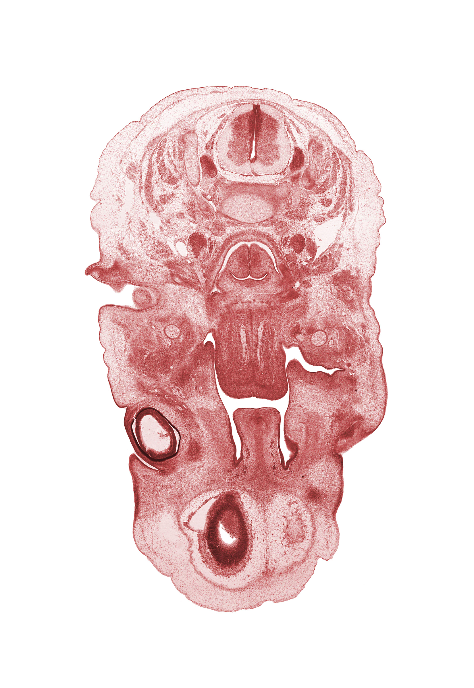 C-3 / C-4 intervertebral disc, C-4 spinal ganglion, auricle, blastema of extra-ocular muscle(s), edge of cerebral vesicle(s), edge of lateral ventricle, external acoustic meatus, frontal prominence, hypoglossal nerve (CN XII), inferior alveolar nerve, inferior ganglion of vagus nerve (CN X), infra-orbital nerve, intraretinal space (optic vesicle cavity), larynx, lingual nerve, nasal septum, optic cup cavity, semispinalis capitis muscle, semispinalis cervicis muscle, spinal accessory nerve (CN XI), splenius muscle, superior cervical sympathetic ganglion, trapezius muscle, vertebral artery