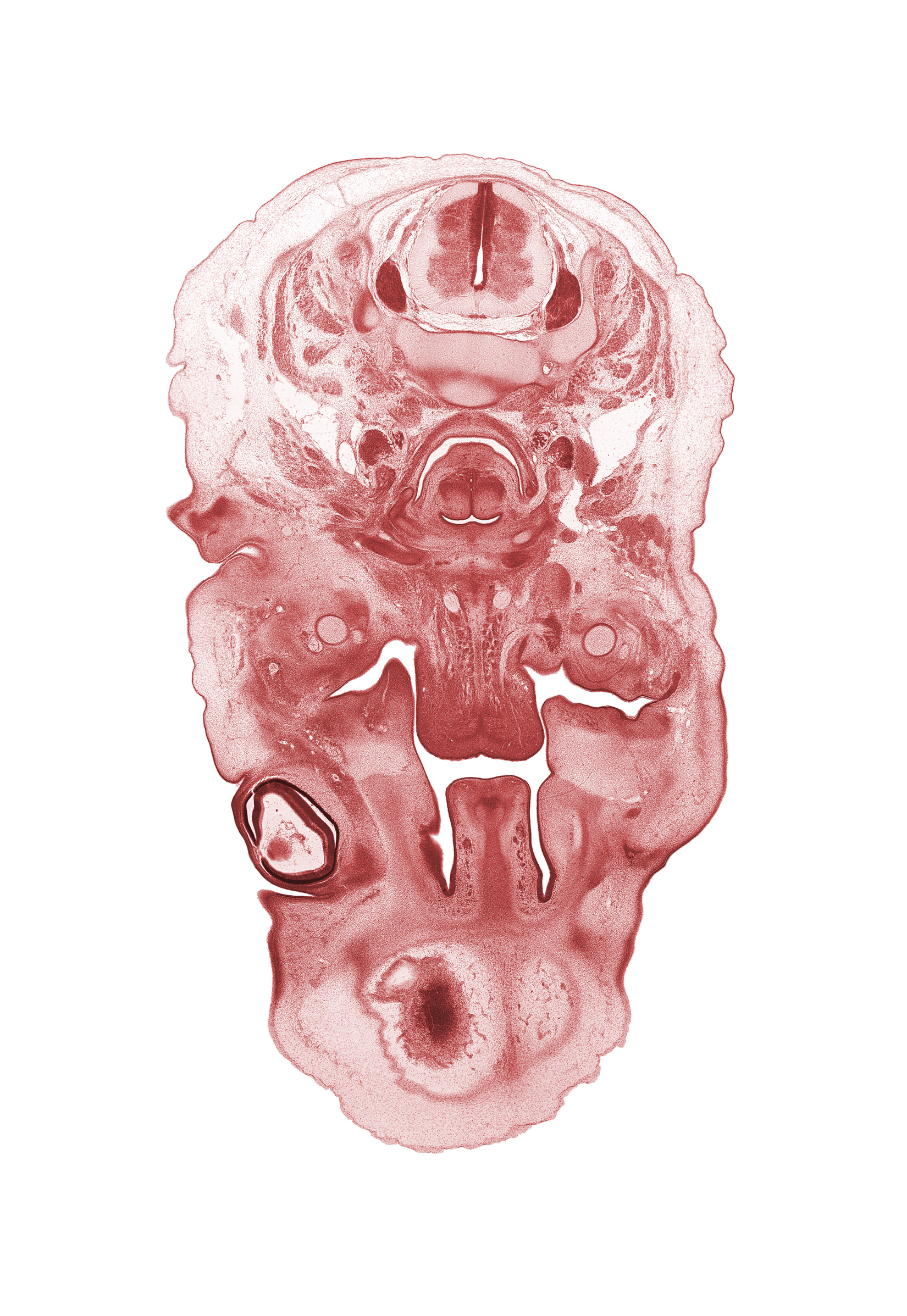 C-3 / C-4 intervertebral disc, C-4 spinal ganglion, blastemata of tongue muscles, body of tongue, edge of cerebral vesicle(s), ethmoid condensation, external acoustic meatus, hypoglossal nerve (CN XII), internal jugular vein, jugular lymph sac, laryngeal pharynx, lingual nerve, loose connective tissue, middle pharyngeal constrictor muscle, palatine shelf, pharyngeal arch 1 cartilage (Meckel), subarachnoid space, submandibular ganglion, superior nasal concha, surface ectoderm, vertebral artery