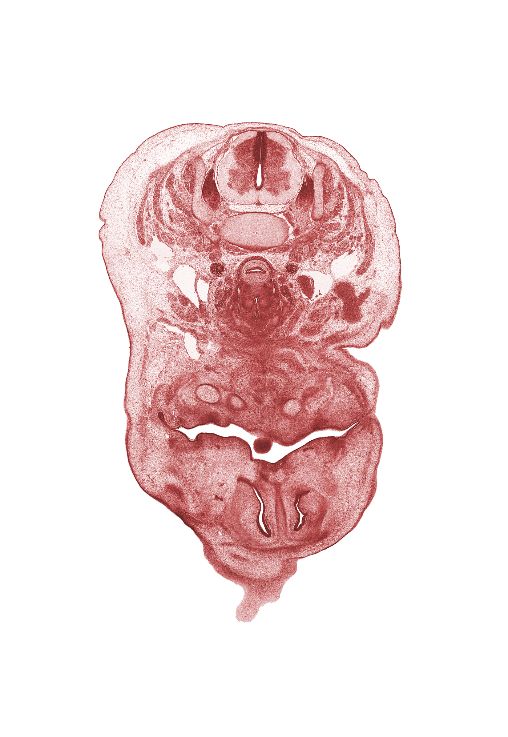 C-5 spinal ganglion, C-5 spinal nerve, blastema of facial muscle, buccal region, edge of frontal prominence, esophagus lumen, external jugular vein, internal carotid artery, internal jugular vein, interorbital ligament, neural arch, oral cavity, pharyngeal arch 1 cartilage (Meckel), platysma muscle, retro-esophageal space, superior parathyroid gland, tip of tongue, trapezius muscle, vertebral artery