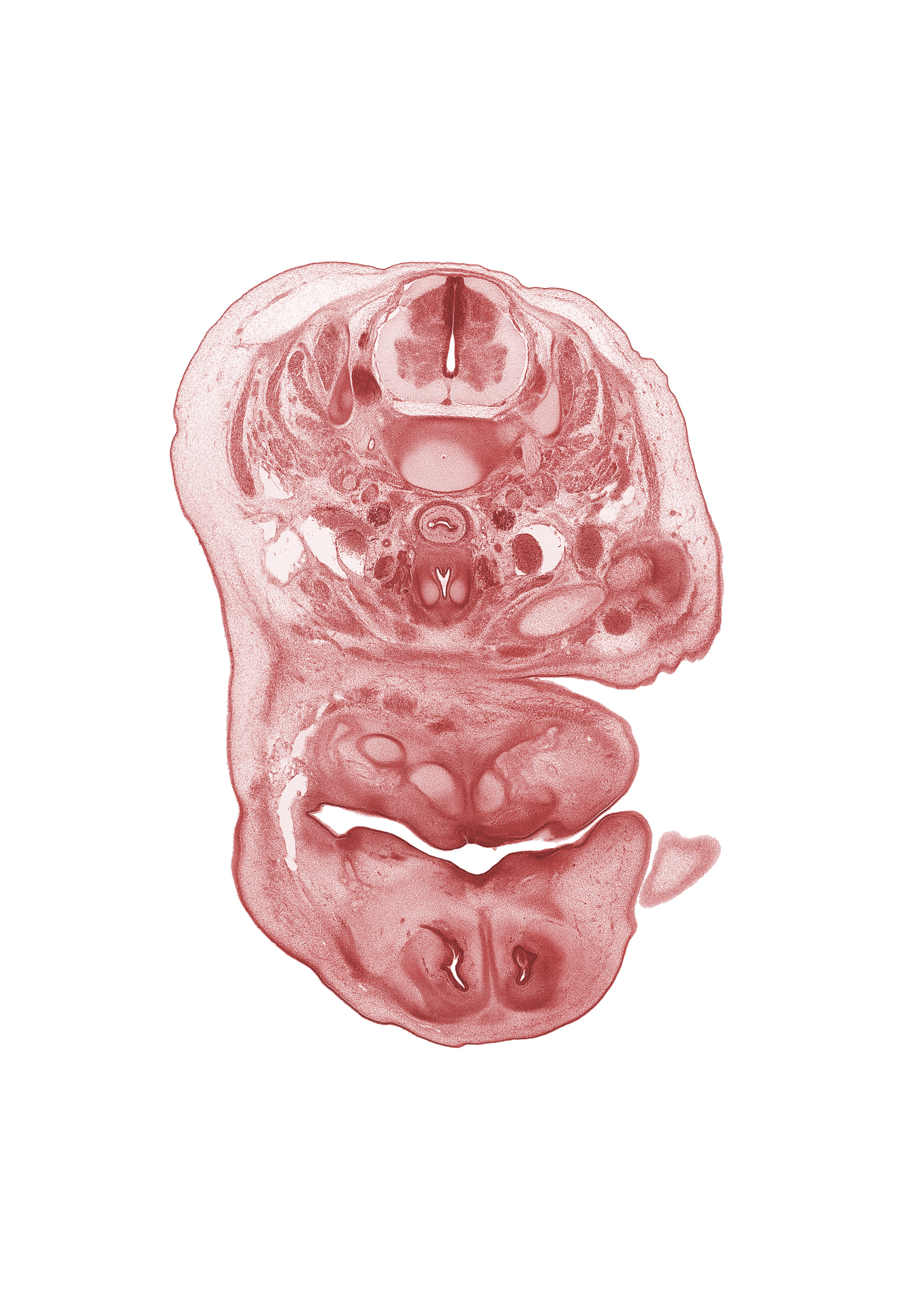 C-5 / C-6 intervertebral disc, C-6 spinal ganglion, C-6 spinal nerve, anterior spinal artery, central canal, clavicle, edge of upper limb, inferior parathyroid gland, internal carotid artery, interorbital ligament, jugular lymph sac, laryngeal cartilage, median mandibular groove, nasal capsule, oral cavity, platysma muscle, primary palate, thyroid gland, vertebral artery