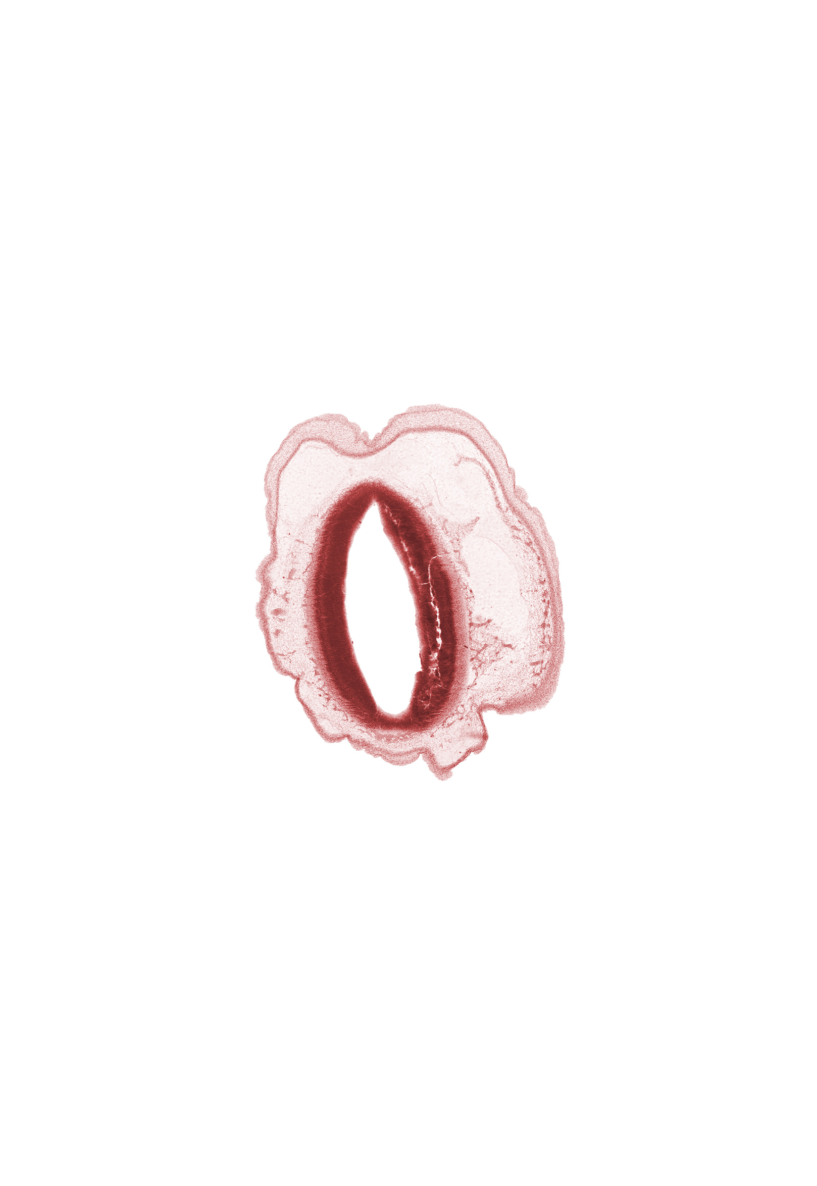 artifact fracture(s), cerebral aqueduct (mesencoel), loose connective tissue, osteogenic layer, subarachnoid space, surface ectoderm, vascular plexus