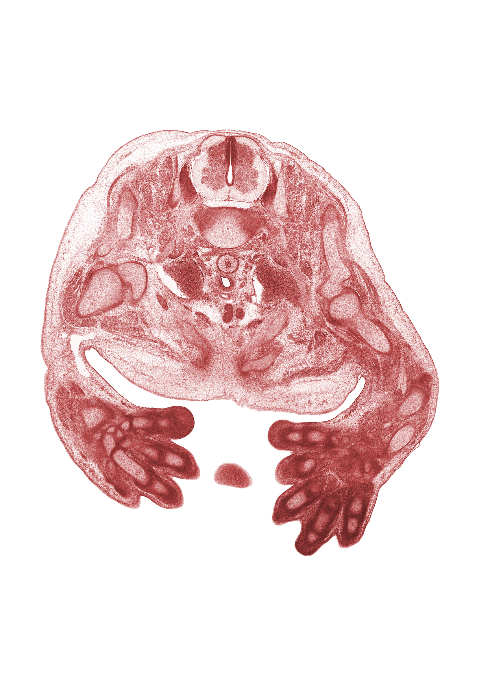 C-7 spinal ganglion, C-7 spinal nerve, blastemata of flexor muscles in forearm, brachiocephalic artery, central canal, dorsal funiculus, edge of nose, glenohumeral joint, intermediate phalynx of digit 4 (ring finger), lateral funiculus, left common carotid artery, left subclavian artery, presumptive origin of left brachiocephalic vein, presumptive termination of left brachiocephalic vein, radial nerve, radius, rib 1, right lobe of thymus gland, scapula, subclavian vein, ventral funiculus