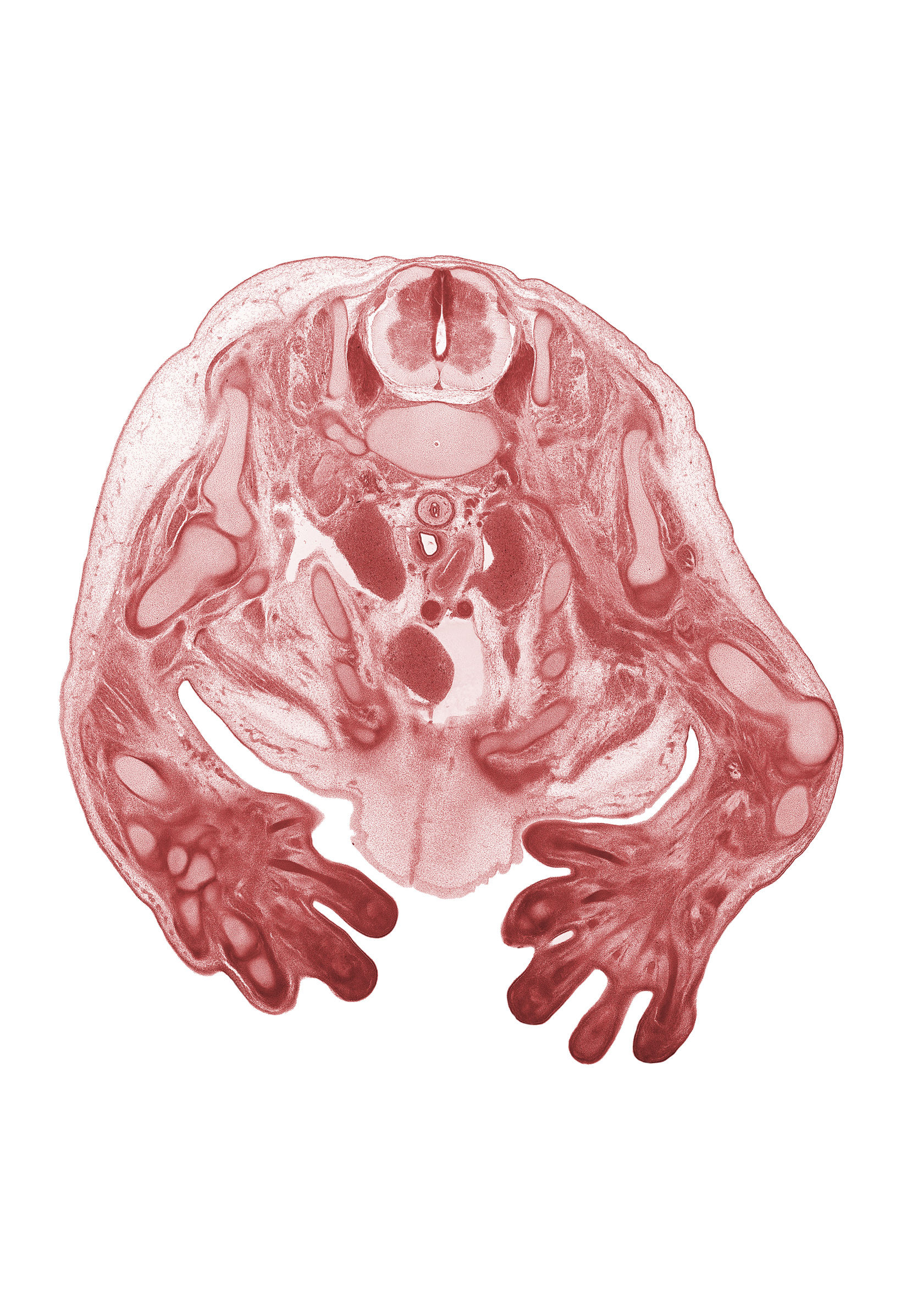 C-8 spinal ganglion, arch of aorta, axillary vein, blastemata of flexor muscles in forearm, esophagus, median nerve, pericardial cavity, presumptive left brachiocephalic vein, radius, rhomboid minor muscle, rib 1, right atrium, right lobe of thymus gland, scapula, subclavian vein, superior vena cava, trachea, triceps brachii muscle, trochlea of humerus, ulna