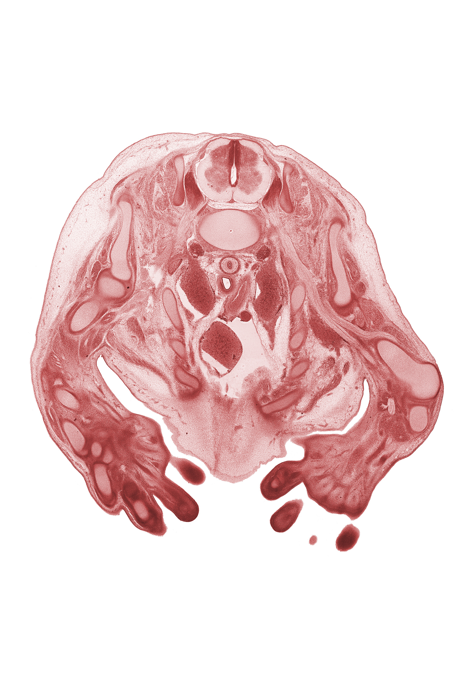 C-8 spinal ganglion, C-8 spinal nerve, arch of aorta, axillary nerve, digit 2 (index finger), digit 3 (middle finger), heart prominence, humerus, inferior cervical sympathetic ganglion, left subclavian artery, lower trunk of brachial plexus (C-8, T-1), medial cord of brachial plexus, median nerve, palm, posterior cord of brachial plexus, radial nerve, radius, rhomboid minor muscle, right atrium, scapula, subscapularis muscle, superior vena cava, ulna, ulnar nerve