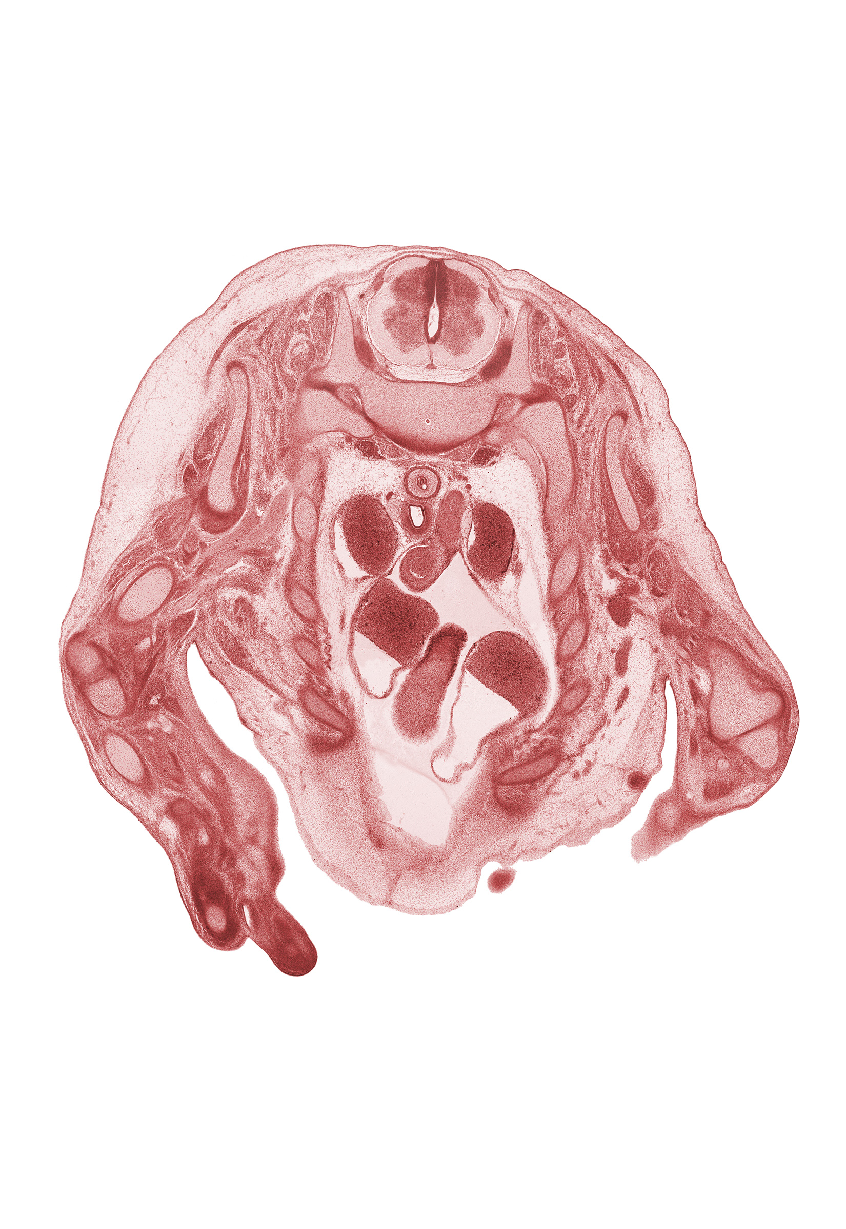 T-1 spinal ganglion, aorta, ascending aorta, caudal edge of left digit 2 (index finger), caudal segment of left precardinal vein, cephalic edge of right ventricle, digit 5 (little finger), ductus arteriosus, elbow joint, esophagus, head of rib 1, left atrium, mammary gland, neural arch, phrenic nerve, radius, rib 3, right atrium, right vagus nerve (CN X), superior vena cava, trachea, ulna