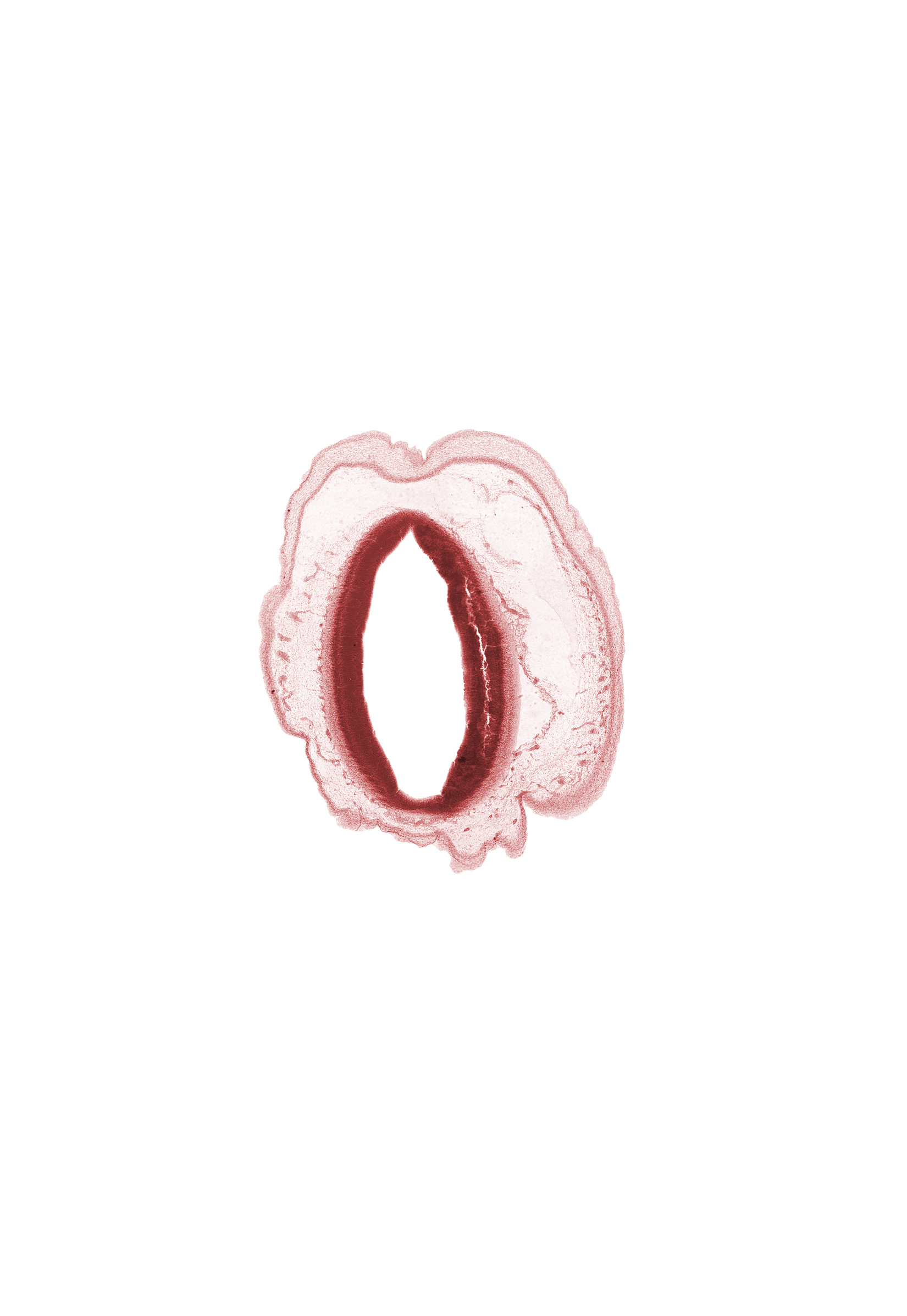 artifact fracture(s), artifact separation(s), mesencephalon, osteogenic layer, surface ectoderm