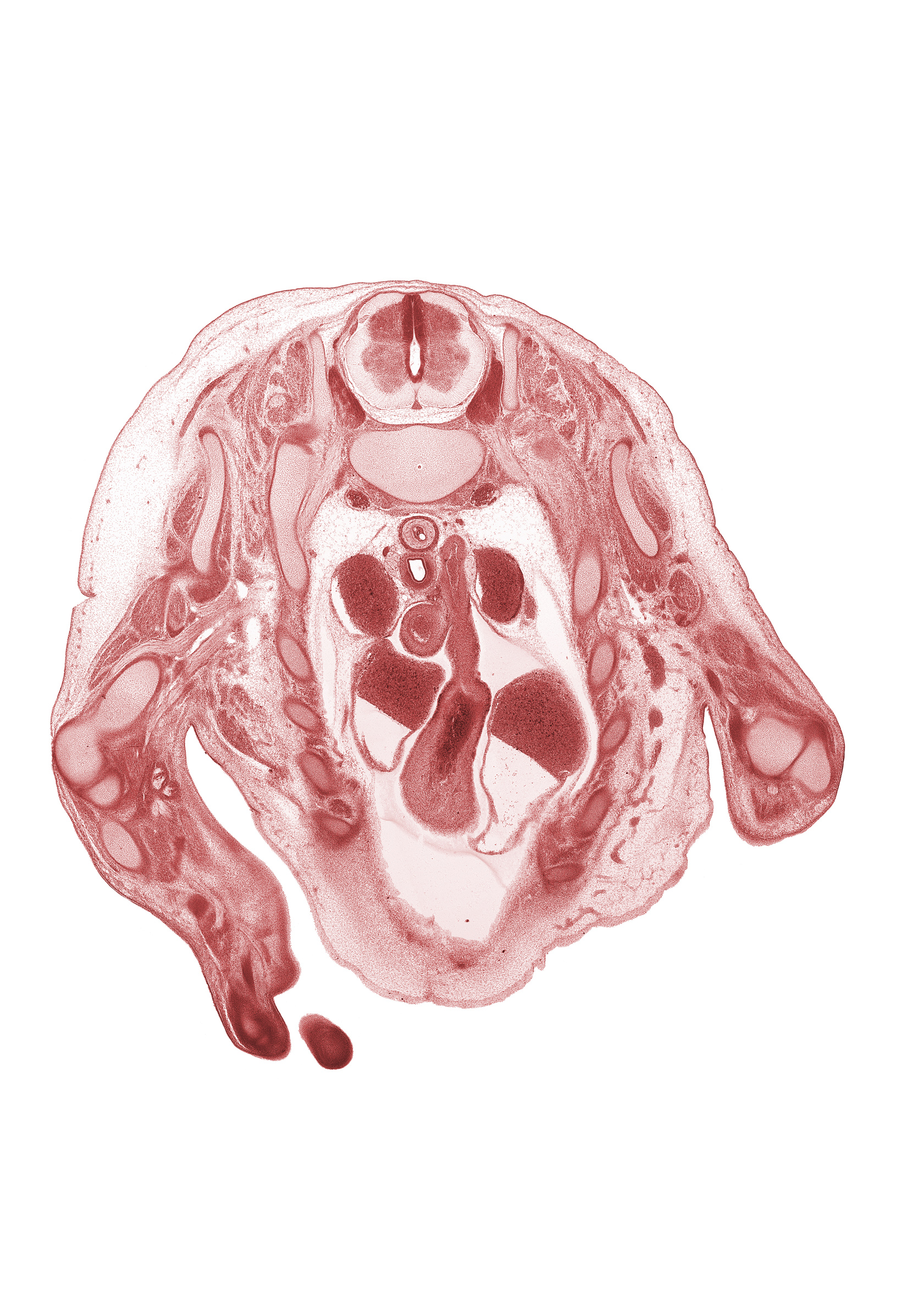 T-1 spinal ganglion, T-1 spinal nerve, aorta, ascending aorta, capitulum of humerus, ductus arteriosus, esophagus, head of radius, infundibulum of right ventricle, left atrium, pericardial cavity, pulmonary semilunar valve, pulmonary trunk, rib 2, right atrium, right ventricle, scapula, superior vena cava, sympathetic trunk, trachea, ulna