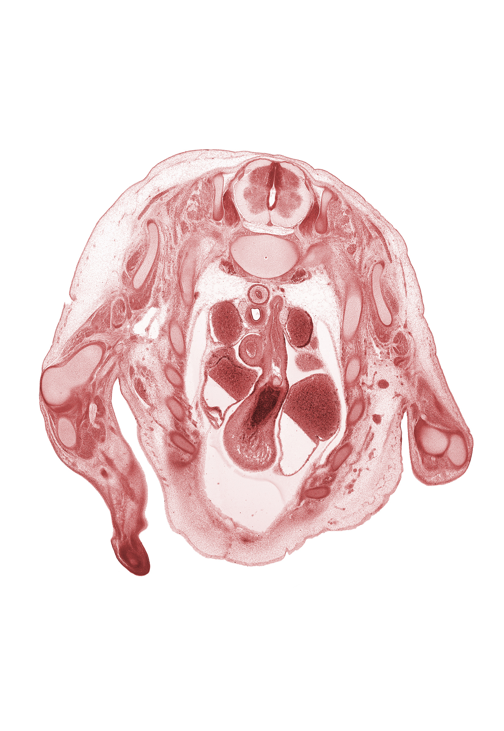 T-1 spinal ganglion, aorta, ascending aorta, caudal segment of left precardinal vein, dorsal horn of grey matter, ductus arteriosus, infundibulum of right ventricle, left atrium, left vagus nerve (CN X), pulmonary trunk, rib 10, rib 2, rib 8, right atrium, right vagus nerve (CN X), right ventricle, superior vena cava, ulna, ventral horn of grey matter