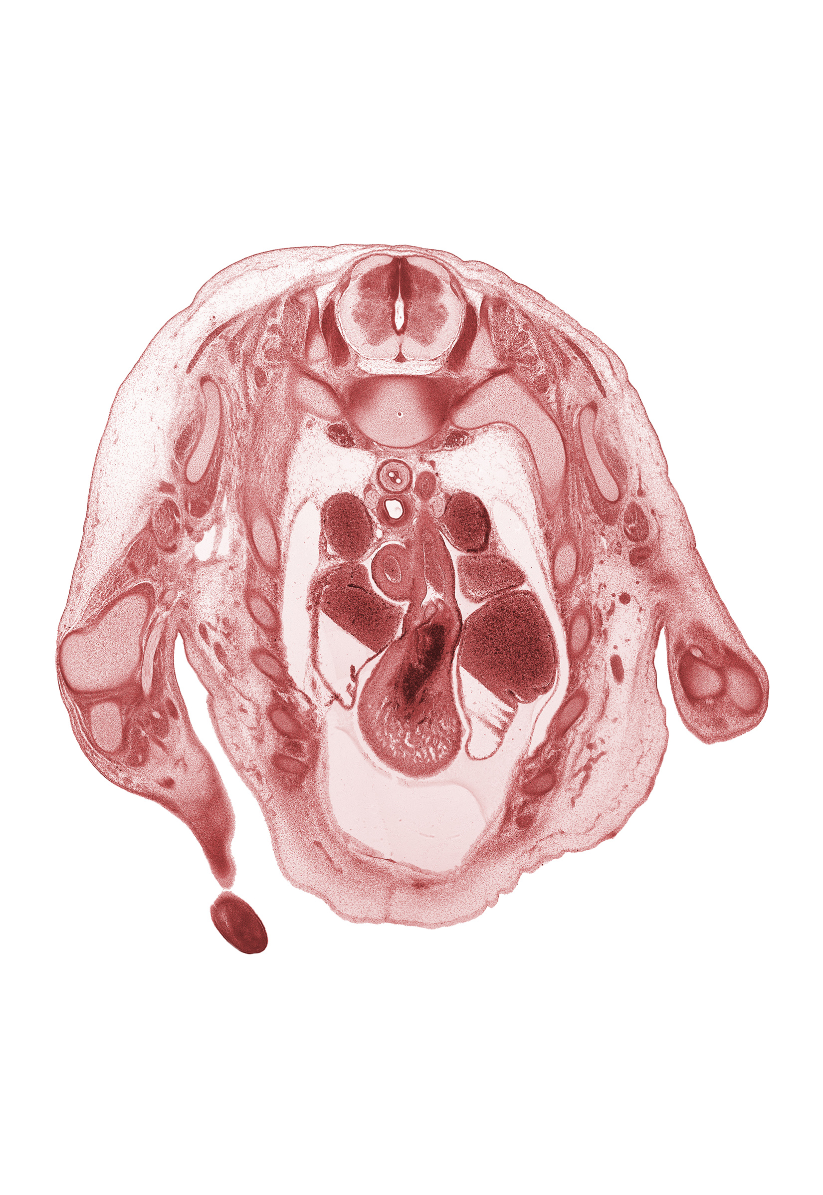 T-1 spinal ganglion, aorta, ascending aorta, blood cells in left atrium, cardiac prominence, esophagus, head of rib 2, intermediate zone, marginal zone, musculi pectinati in wall of left auricle, musculi pectinati in wall of right auricle, pericardial cavity, phrenic nerve, pulmonary semilunar valve, pulmonary trunk, superior vena cava, sympathetic ganglion, trachea, ulna, ulnar nerve, ventricular zone
