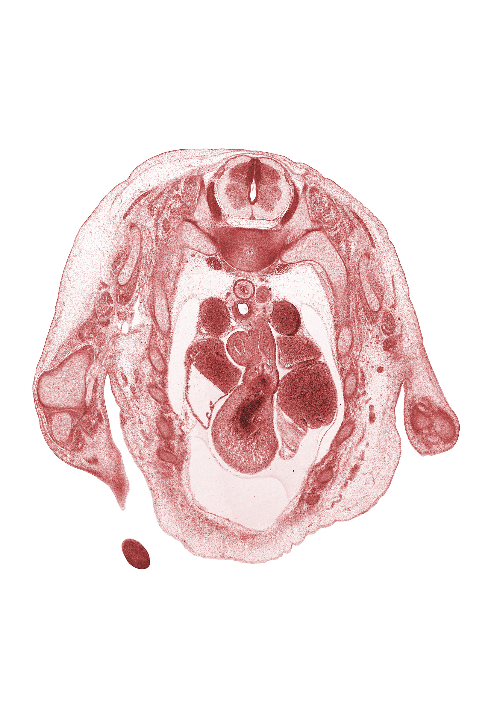 T-1 spinal ganglion, ascending aorta, head of rib 2, infundibulum of right ventricle, left vagus nerve (CN X), pulmonary semilunar valve, pulmonary trunk, rhomboid muscle, rib 3, right atrium, right vagus nerve (CN X), scapula, subscapularis muscle, sympathetic trunk, trabecular part of right ventricle, ulnar nerve