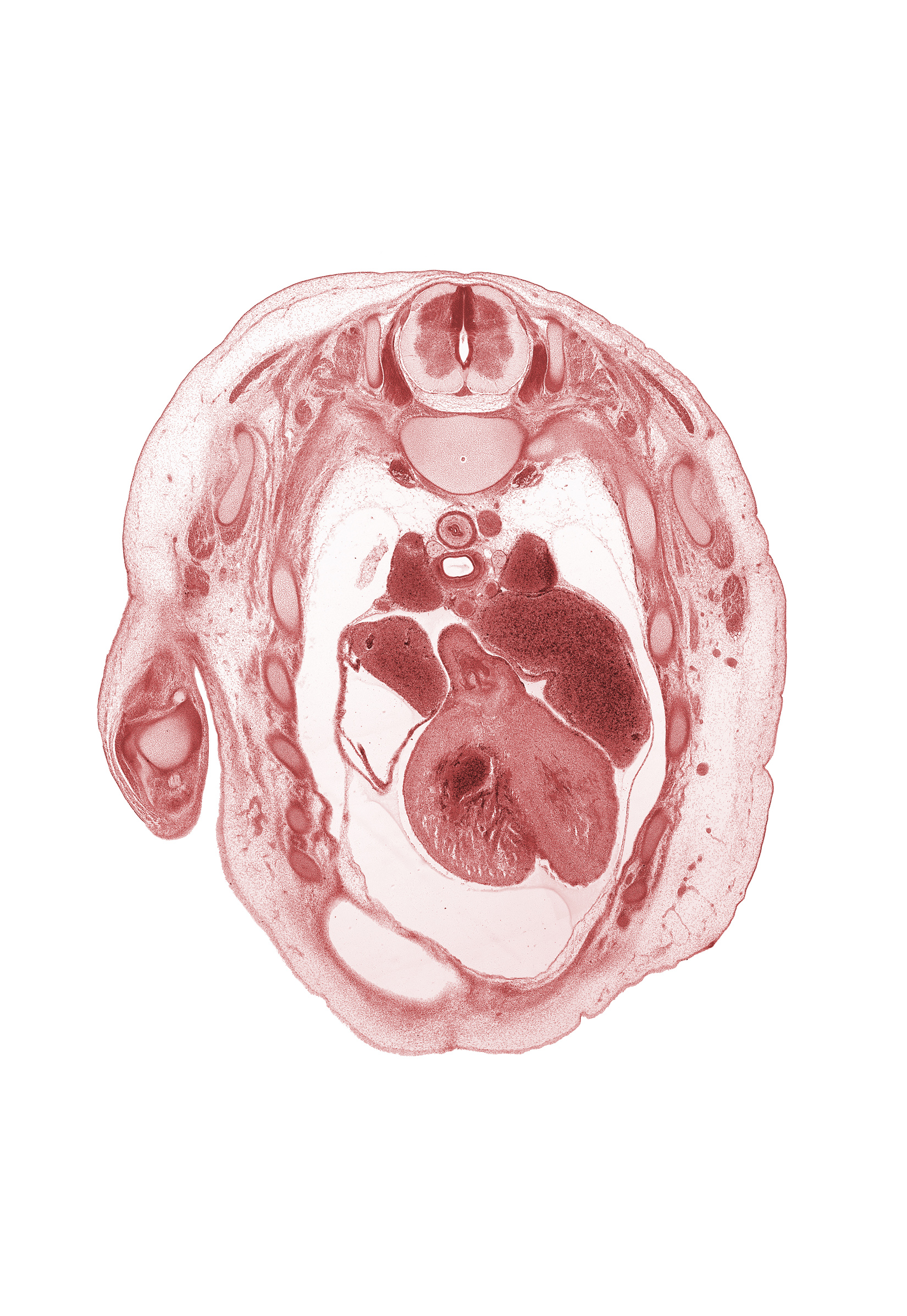 T-2 spinal ganglion, T-2 spinal nerve, anterior interventricular sulcus, aortic semilunar valve, apex of right lung, arch of azygos vein, edge of peritoneal cavity, left atrium, left ventricle, pericardial cavity, rib 3, right atrium, right ventricle, superior vena cava, teres major muscle, trachea, transverse pericardial sinus, trapezius muscle