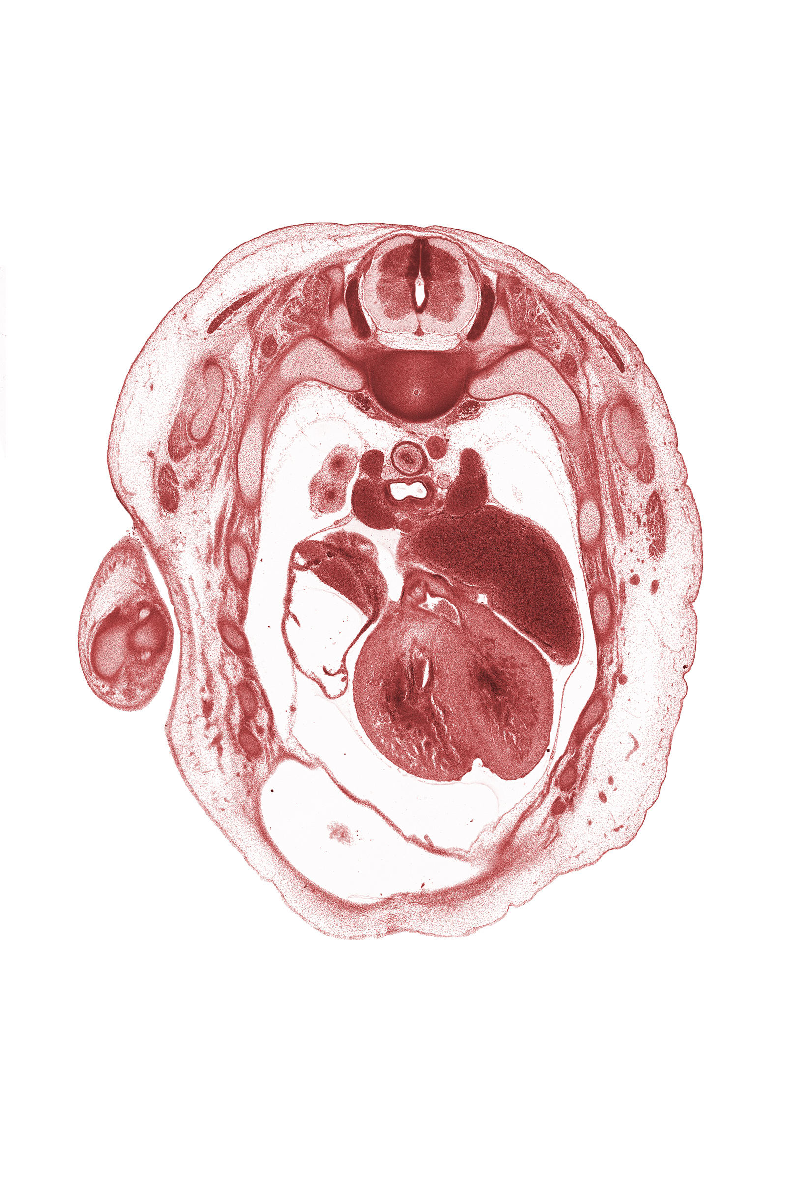 aortic vestibule, cephalic edge of liver, infundibulum of right ventricle, left atrium, pericardial cavity, peritoneal cavity, pleural cavity, primary bronchus, rib 3, rib 4, right atrium, sympathetic trunk, upper lobe of right lung