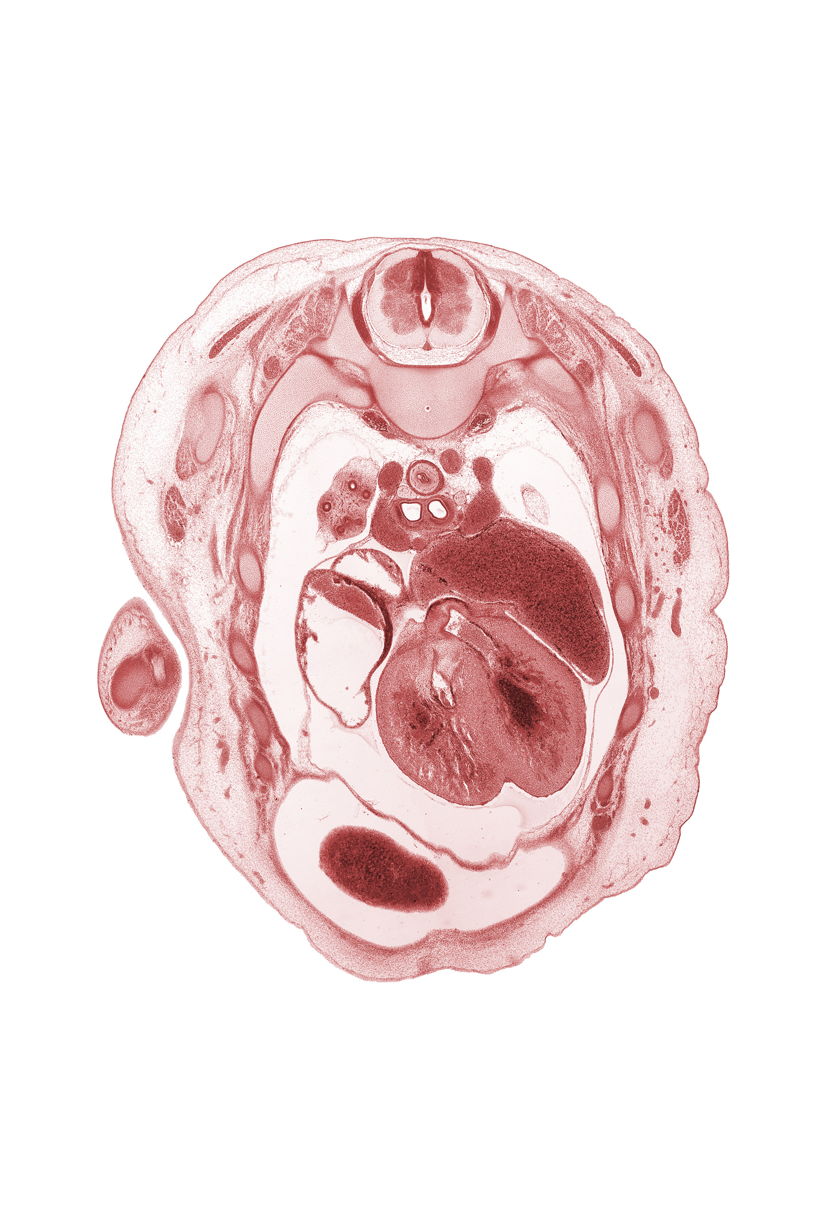 T-3 spinal ganglion, aorta, aortic vestibule, atrioventricular sulcus, auricle of left atrium, azygos vein, left horn of sinus venosus, membranous part of interventricular septum, muscular part of interventricular septum, primary bronchus, rib 3, rib 4, rib 6, right atrium, right lobe of liver, scapula, superior vena cava, sympathetic trunk, trabecular part of right ventricle