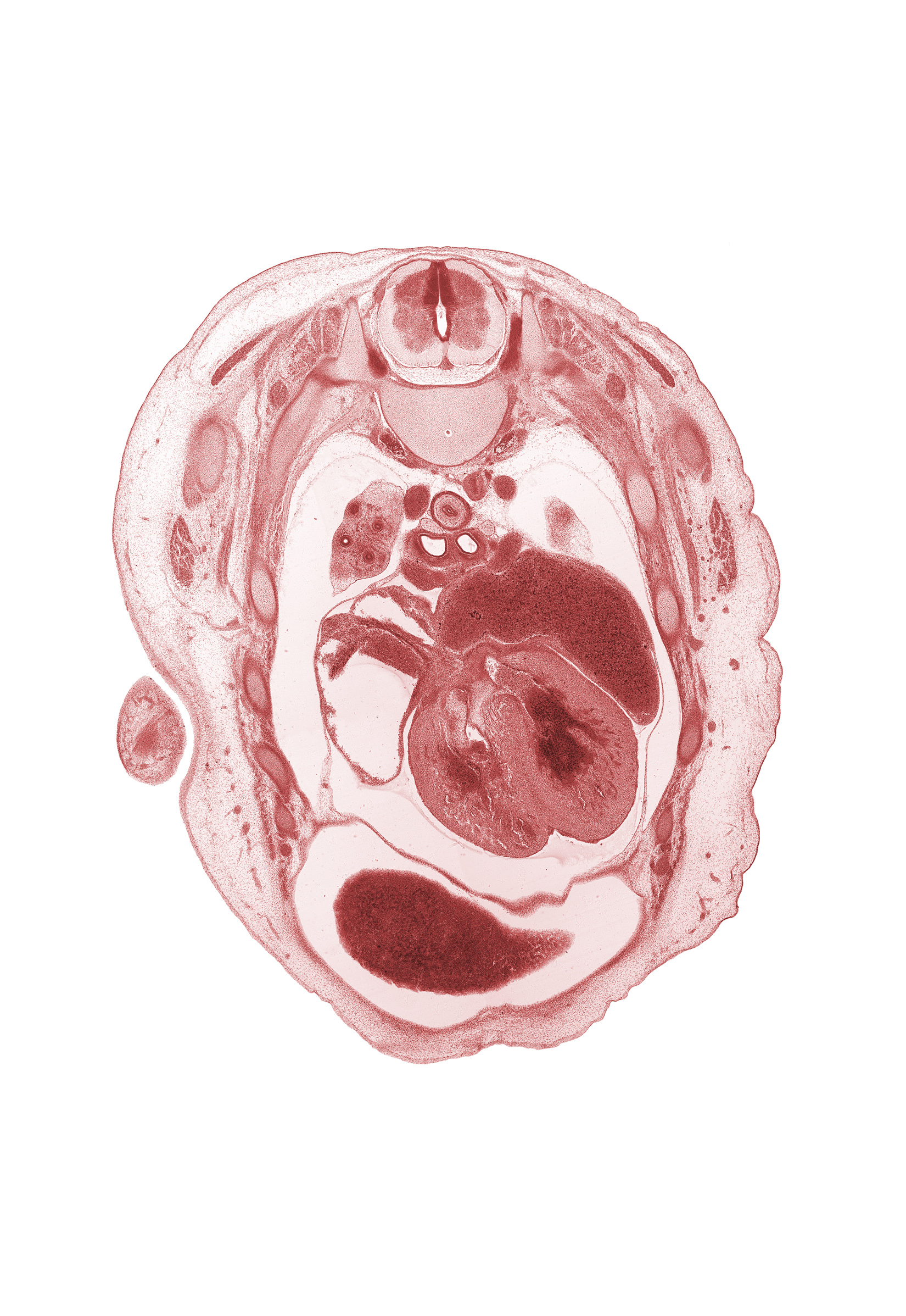 T-3 spinal ganglion, T-3 spinal nerve, aorta, apex of upper lobe of left lung, auricle of right atrium, central tendon of diaphragm, interventricular foramen, interventricular septum, latissimus dorsi muscle, left atrium, left horn of sinus venosus, left vagus nerve (CN X), primary bronchus, pulmogenic coat, rib 4, rib 6, rib 7, right lobe of liver, right vagus nerve (CN X), superior vena cava, upper lobe of right lung
