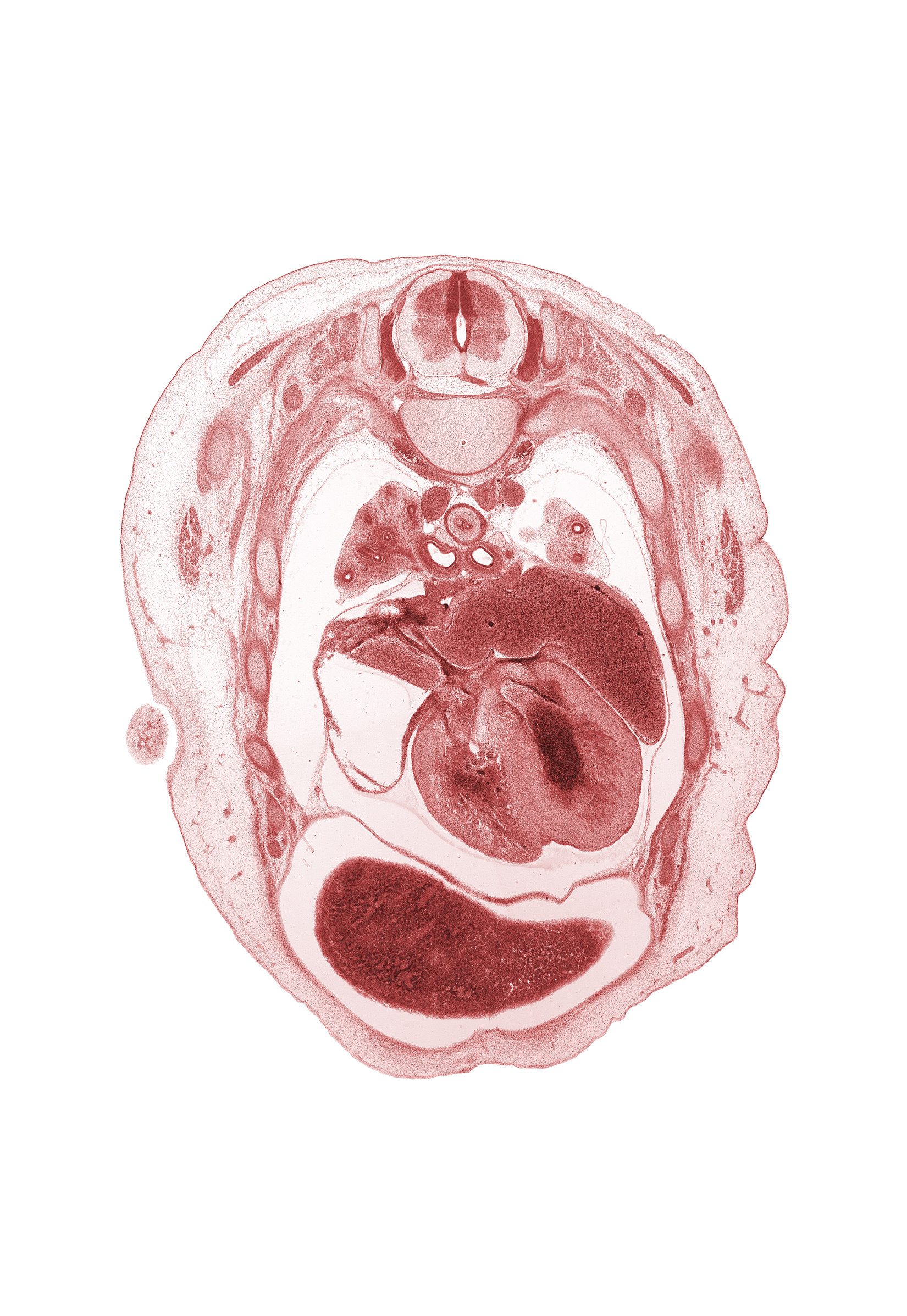 T-3 spinal ganglion, apical segmental bronchus, azygos vein, caudal end of upper limb, central tendon of diaphragm, head of rib 4, iliocostalis muscle, junction of sinus venosus and superior vena cava, left atrium, left horn of sinus venosus, longissimus muscle, muscular part of interventricular septum, pericardial cavity, phrenic nerve, primary bronchus, rhomboid major muscle, rib 5, right atrium, scapula, septum spurium, spinalis muscle, upper lobe of left lung, upper lobe of right lung, upper secondary bronchus