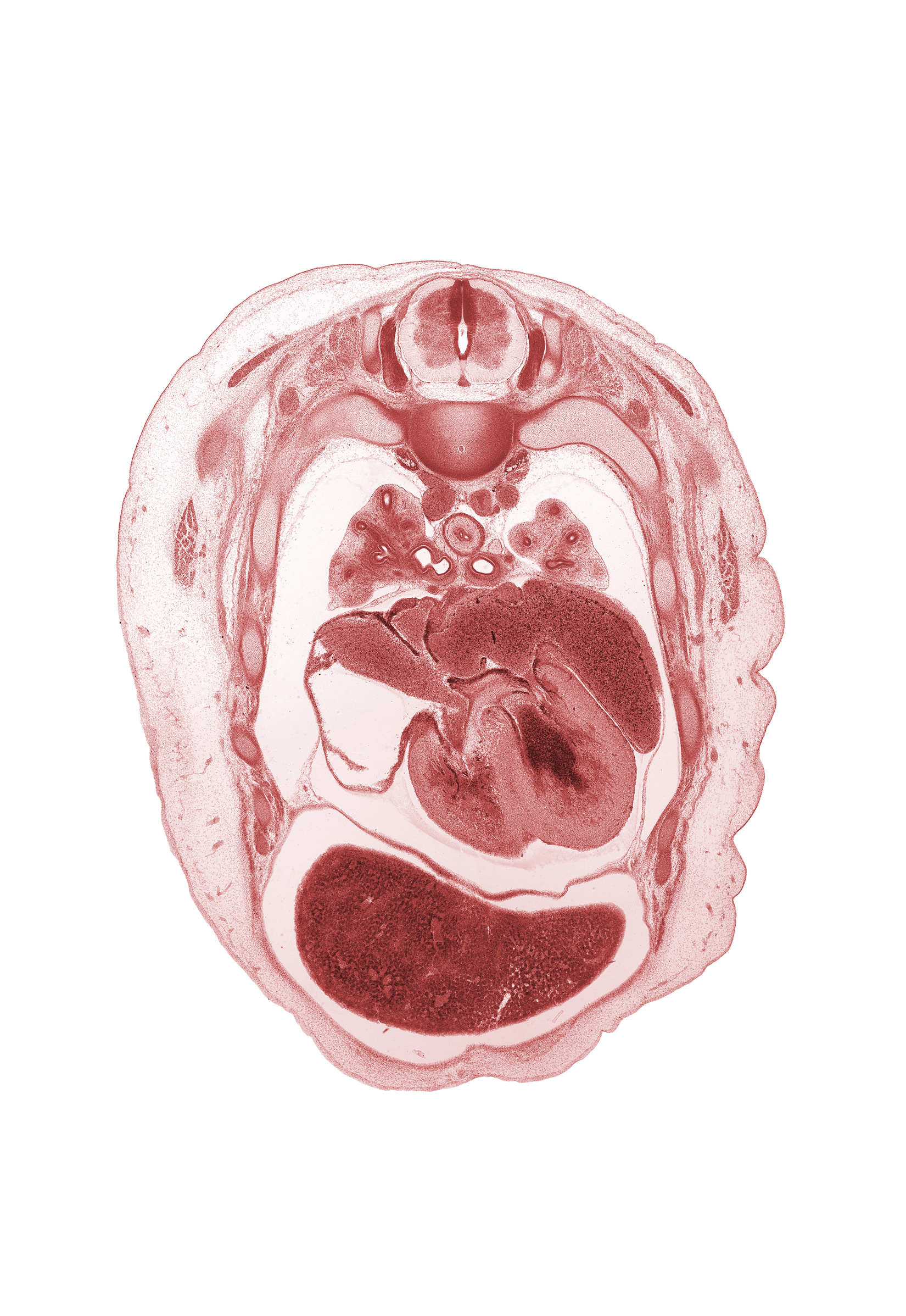 T-3 spinal ganglion, apex of heart, apical segmental bronchus, head of rib 4, latissimus dorsi muscle, left atrioventricular canal, left atrium, left venous valve, left ventricle, primary bronchus, pulmogenic coat, rib 5, right atrioventricular canal, right atrium, right venous valve, right ventricle, sinus venosus, superior hemi-azygos vein, trapezius muscle, upper lobe of left lung, upper secondary bronchus