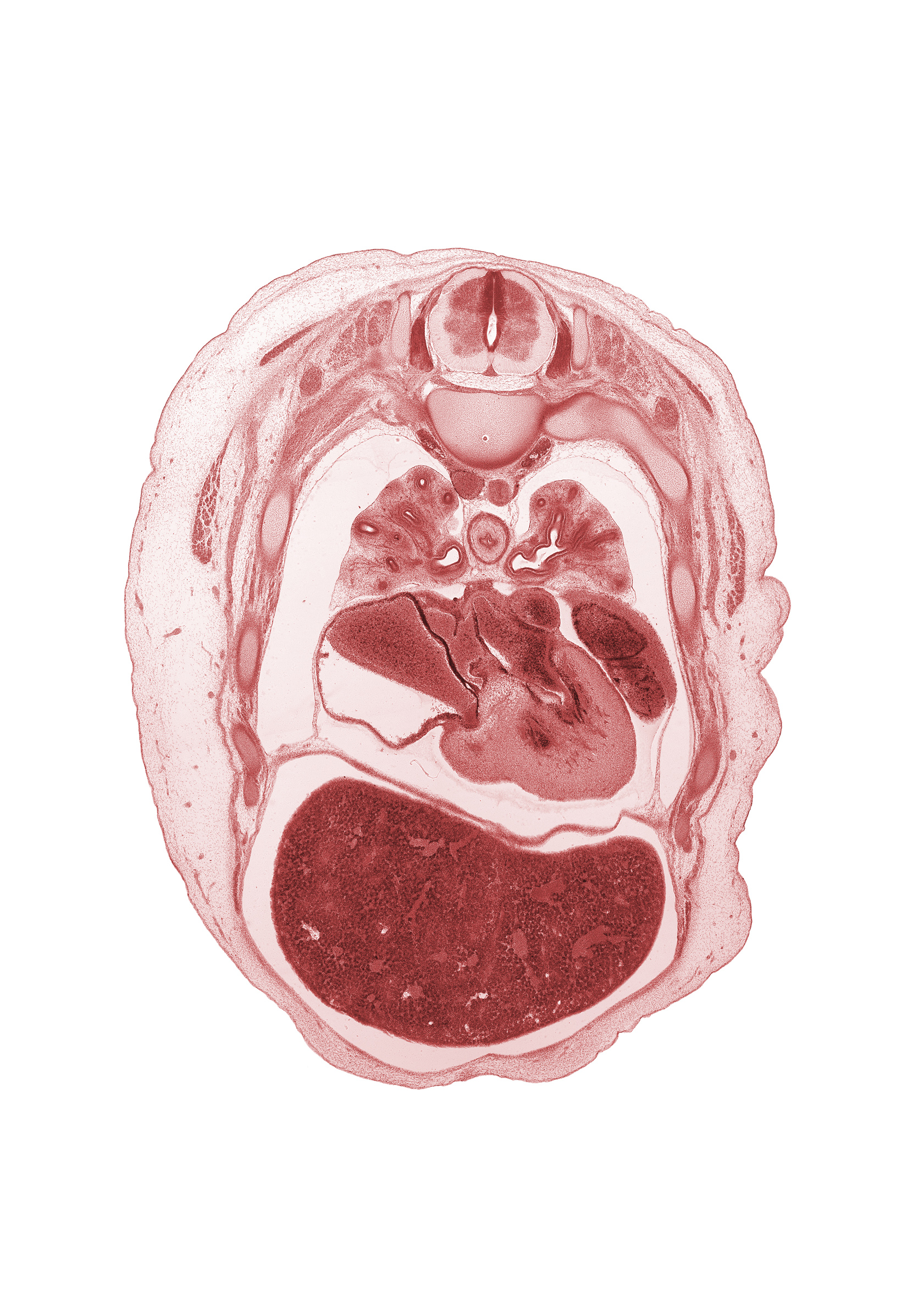 T-4 spinal ganglion, anterior segmental bronchus, azygos vein, foramen ovale, head of rib 5, latissimus dorsi muscle, left atrium, left lobe of liver, lower secondary bronchus, middle secondary bronchus, posterior segmental bronchus, primary interatrial septum (septum primum), rib 6, right atrium, right lobe of liver, secondary interatrial septum (septum secundum), serratus anterior muscle, trapezius muscle, upper secondary bronchus