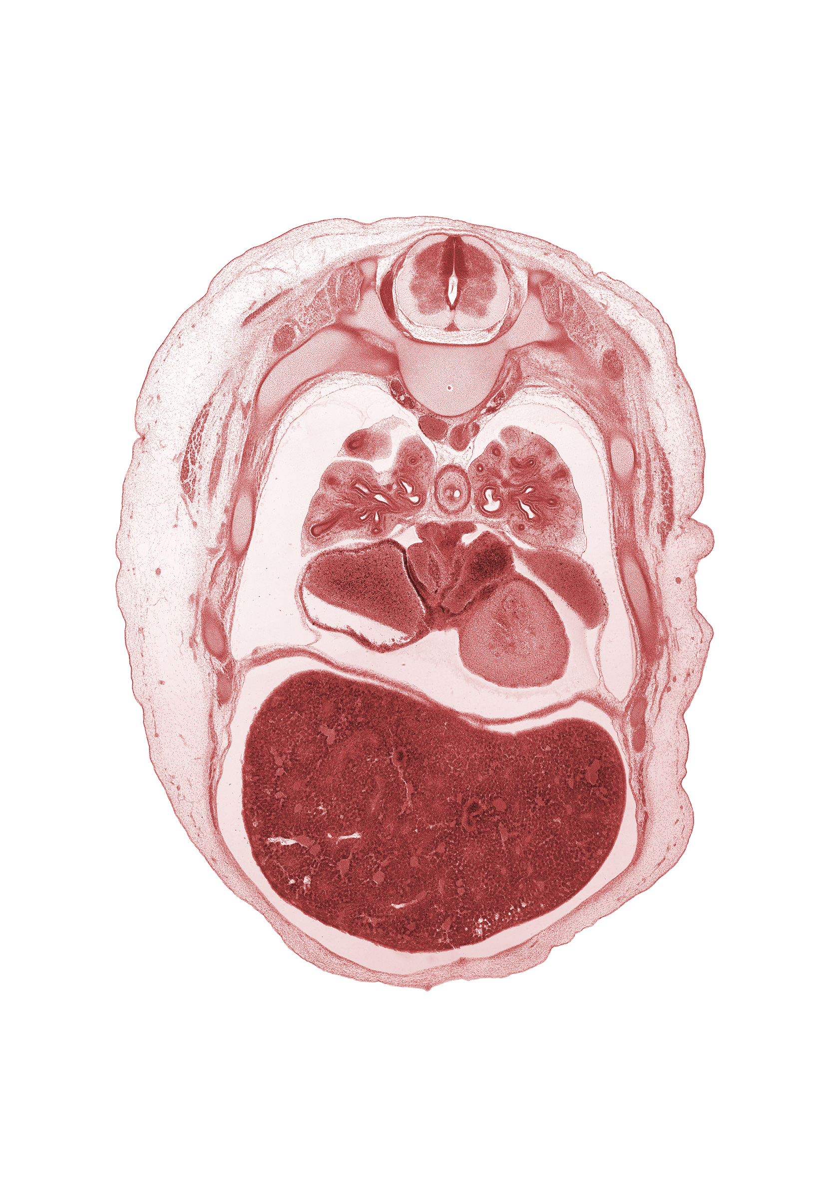 T-4 / T-5 interganglion region, diaphragm, horizontal fissure, lateral segmental bronchus, left lobe of liver, left ventricle, lower lobe of right lung, lower secondary bronchus, medial segmental bronchus, middle lobe of right lung, oblique fissure, pericardial sac, rib 6, rib 7, right atrium, right lobe of liver, right pulmonary vein, upper lobe of left lung, upper lobe of right lung