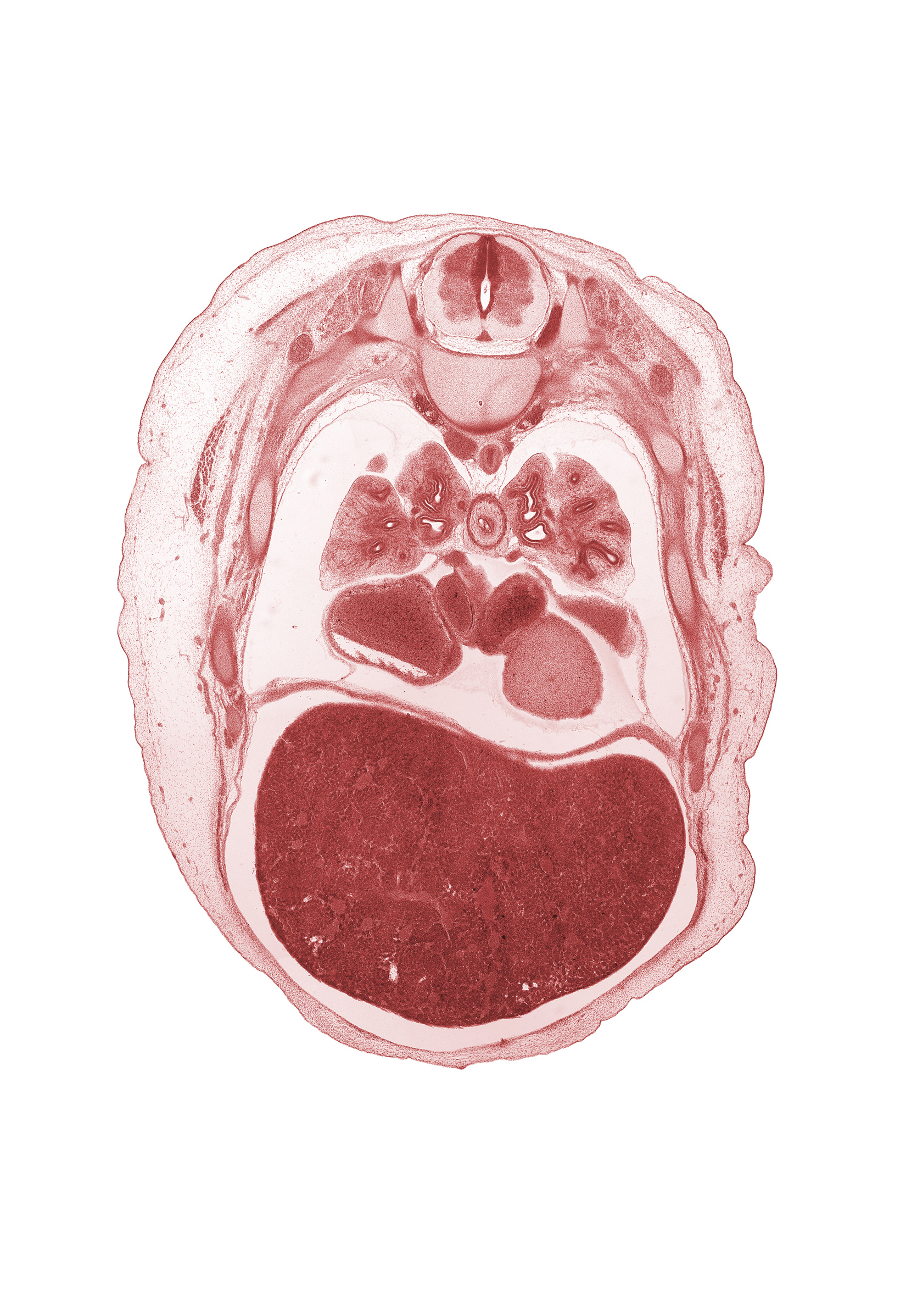 T-5 spinal ganglion, T-5 spinal nerve, azygos vein, caudal edge of upper lobe of right lung, central canal, diaphragm, esophagus endoderm, junction of inferior vena cava and right atrium, left atrium, left lobe of liver, lower lobe of left lung, lower secondary bronchus, oblique fissure, pericardial cavity, peritoneal cavity, pleural cavity, rib 6, rib 7, right lobe of liver, superior segmental bronchus, sympathetic trunk, upper lobe of left lung