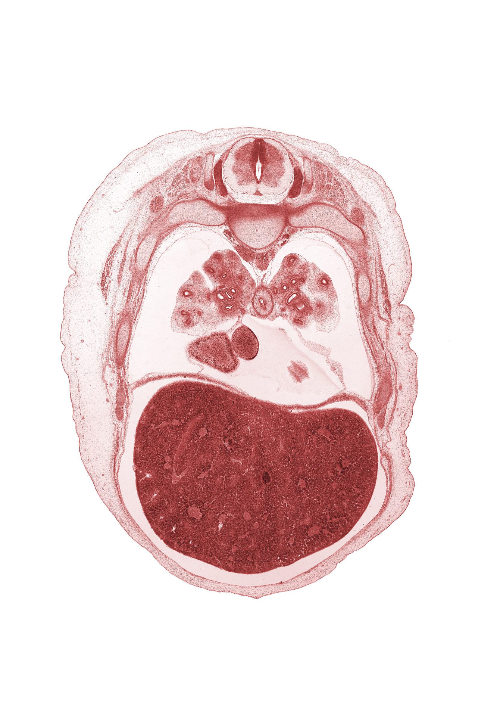 T-5 spinal ganglion, bare area of liver, caudal edge of left ventricle, dorsal funiculus, head of rib 6, inferior vena cava, lateral funiculus, left lobe of liver, lower lobe of left lung, lower lobe of right lung, middle lobe of right lung, oblique fissure, pericardial cavity, pericardial sac, rectus abdominis muscle, rib 7, right atrium, right lobe of liver, subarachnoid space, sympathetic trunk, upper lobe of left lung, ventral funiculus